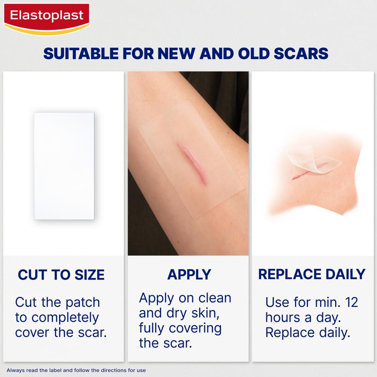 Elastoplast Elastoplast Scar Reducer Plasters (21 Plasters), Quick and Convenient Scar Cover Up Treatment, Scar Sheets to Reduce Visibility of Scars, Scar Plaster Pack for Quick Results, Strong Adhesion Tape