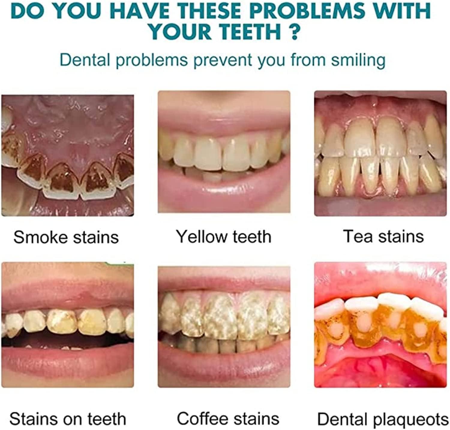 Doduiu Tooth Paint, Instant Teeth Whitening, Tooth Polish Uptight White,Whitening Tooth Paint, Teeth Whitening Essence,Teeth Whitening Paint Kit for Removing Tooth Stains, Regain Confident Smile (3Pcs)