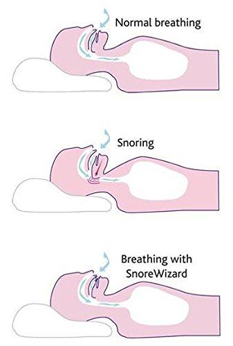 Snorewizard Snorewizard, Stop Snoring, Recommended by UK Sleep Clinics