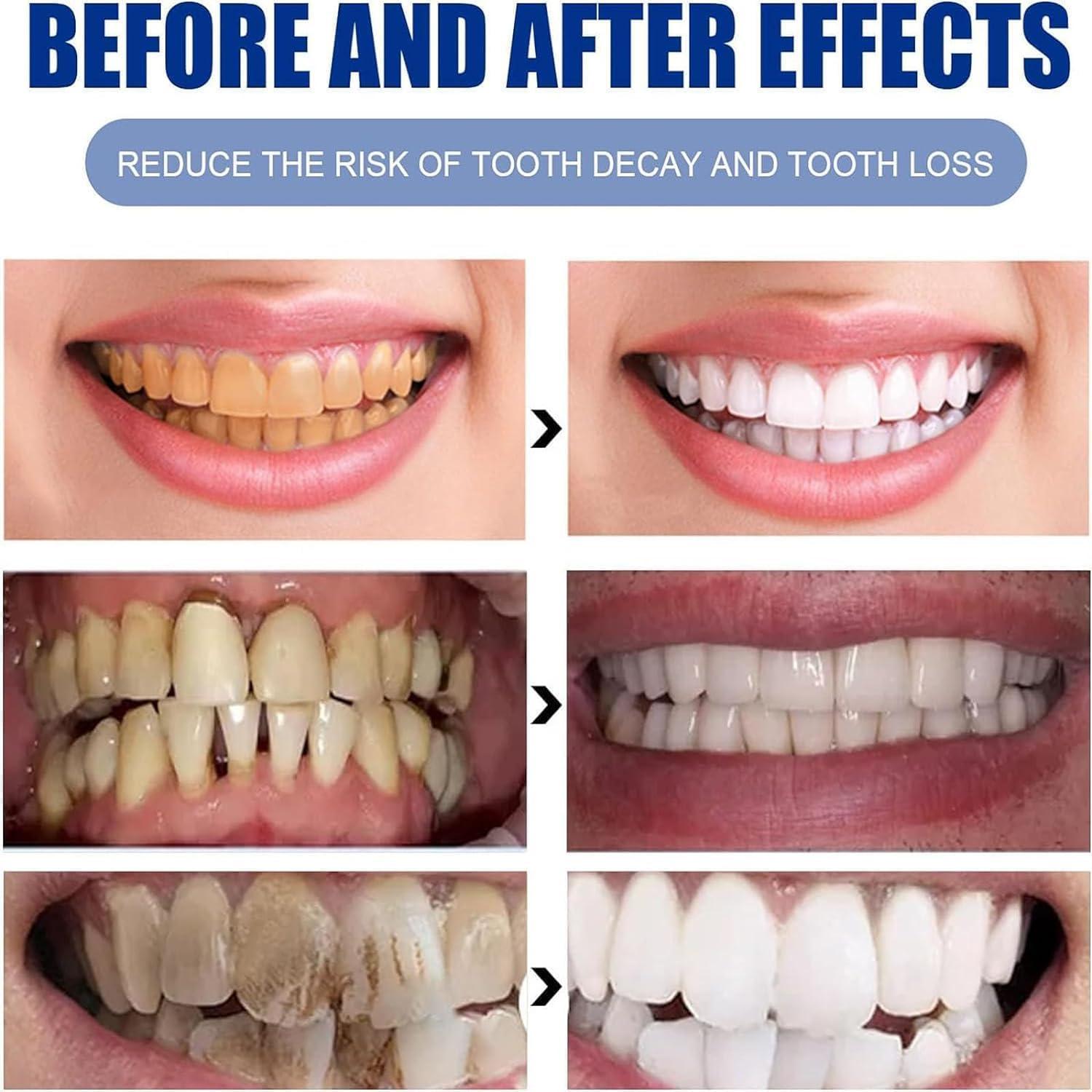 Kolarmo Face U Toothpaste,Face U Baking Soda Toothpaste Natural,Face U Toothpaste with Baking Soda,Face U Whitening Peppermint Toothpaste (3pcs)