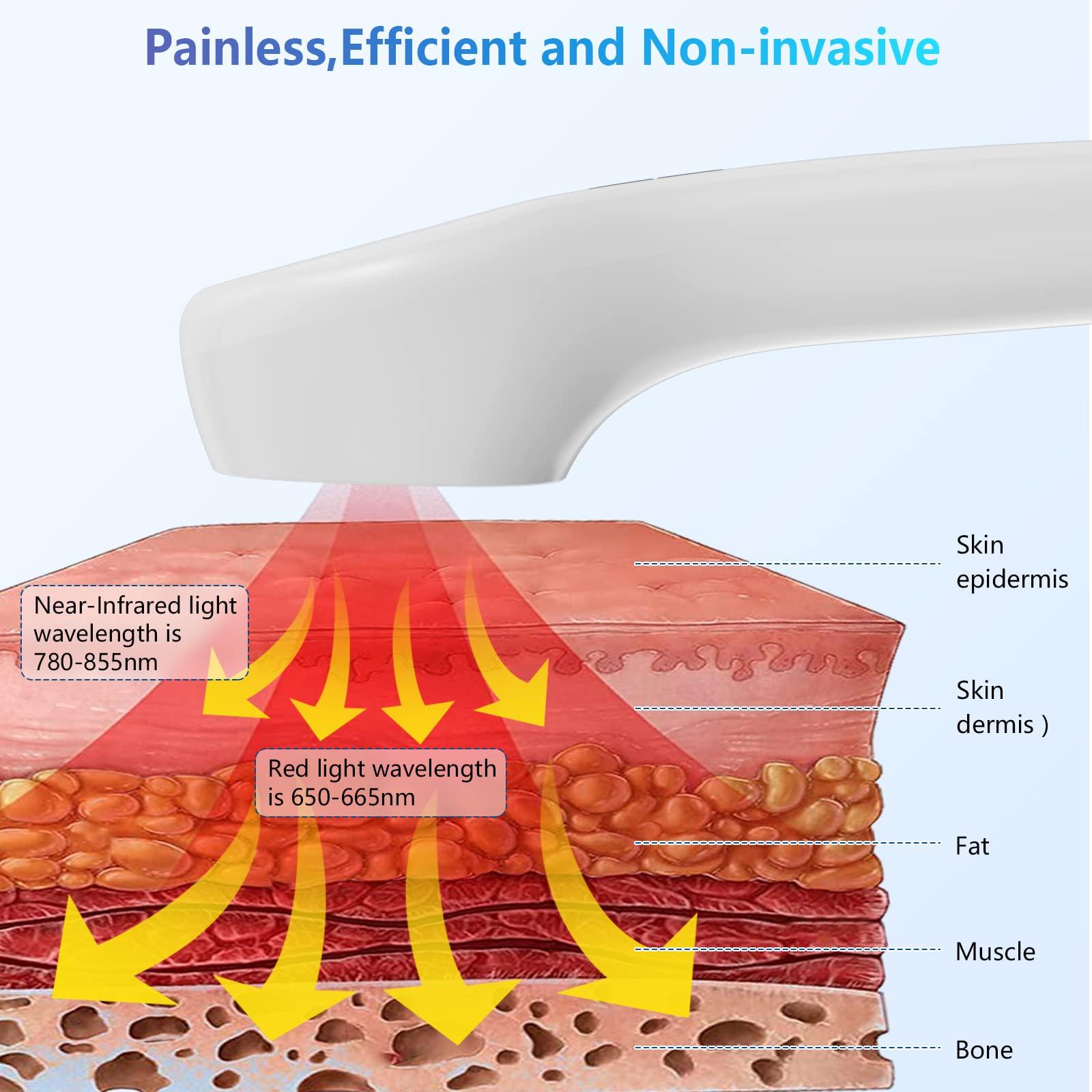 iKeener iKeener Handheld Red Light Therapy Device,(4x808nm +12 X 650nm) Cold Laser Human/Vet Therapy Device for Muscle Reliever,Knee,Shoulder,Back.Infrared Light Therapy Pain Relief Device,with Free Goggles