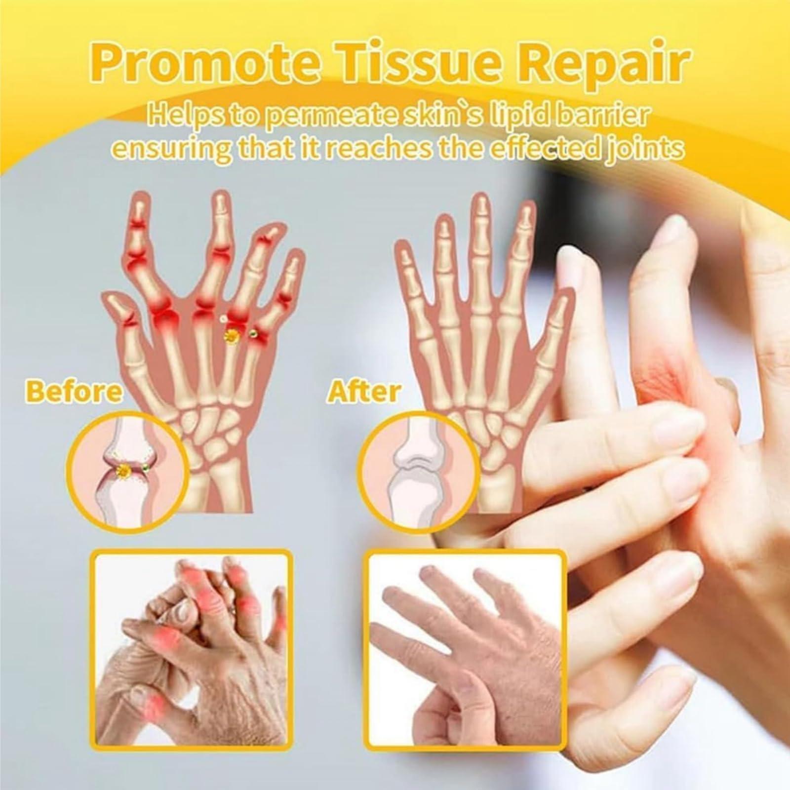 Haiyox 2PCS Bee Venom Cream Joint and Bone Cream,Bee Venom Joint Bone Cream,Bee Venom for Joints,Soothes Itching,Bee Venom Joint Care Cream,Bee Venom and Joint Relief Cream,Bee Venom Joint Soothing Cream