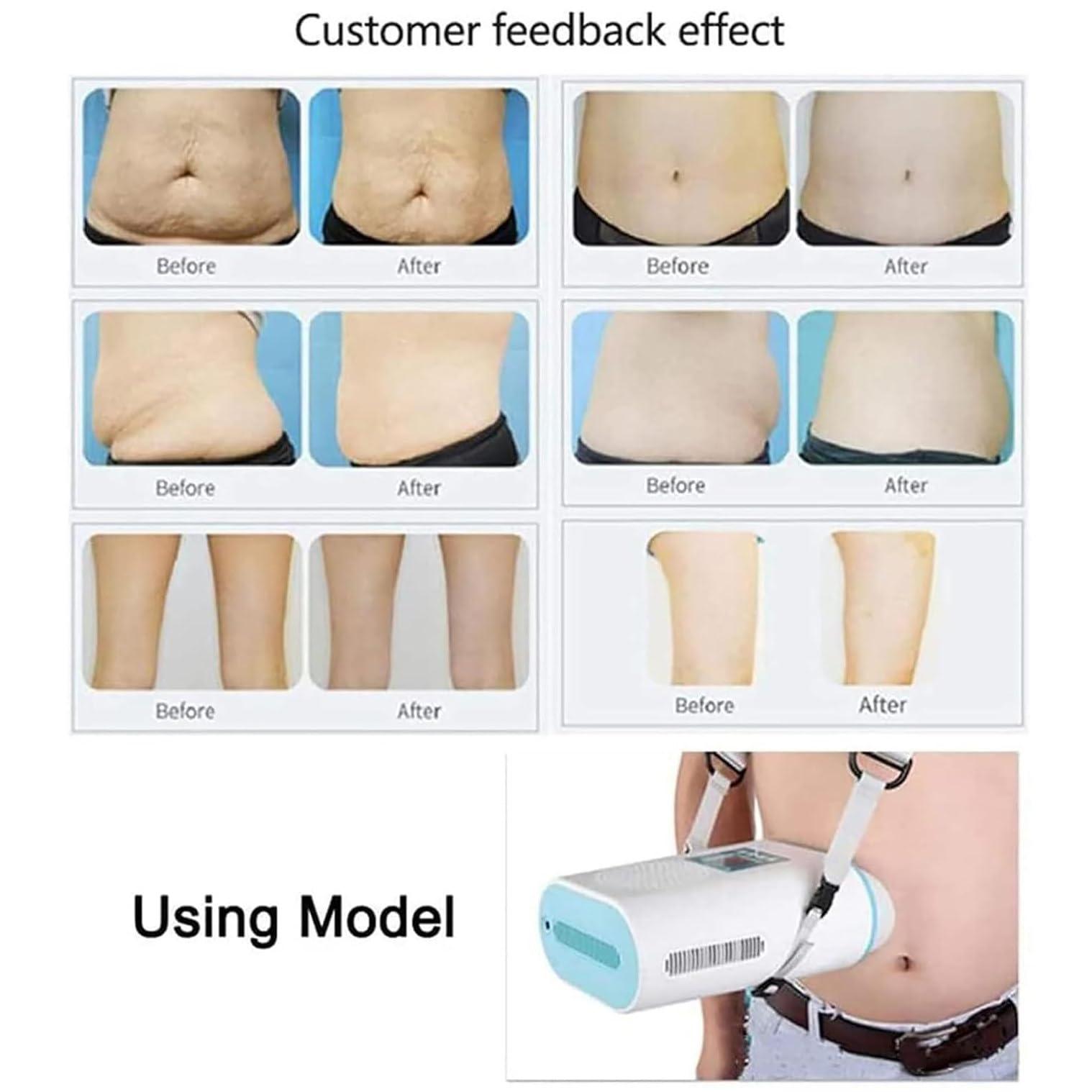 LQQYJSM LQQYJSM 90W Fat Cryoliposys Sculpting Device, Freezing Slimming Machine Burst Fat Instrument, Cool Sculpting Machine for Home, Great for Lose Belly/Arms/Legs Fat