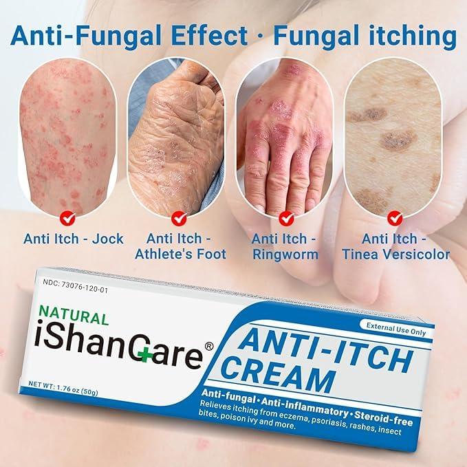 ishancare iShanCare Anti Itch Cream, Maximum Strength Instant Itch Relief for Rash, Eczema, Bug/Mosquito Bites, Psoriasis, Poison Ivy, Dermatitis, Soothing Moisturizer for Dry, Sensitive Skin