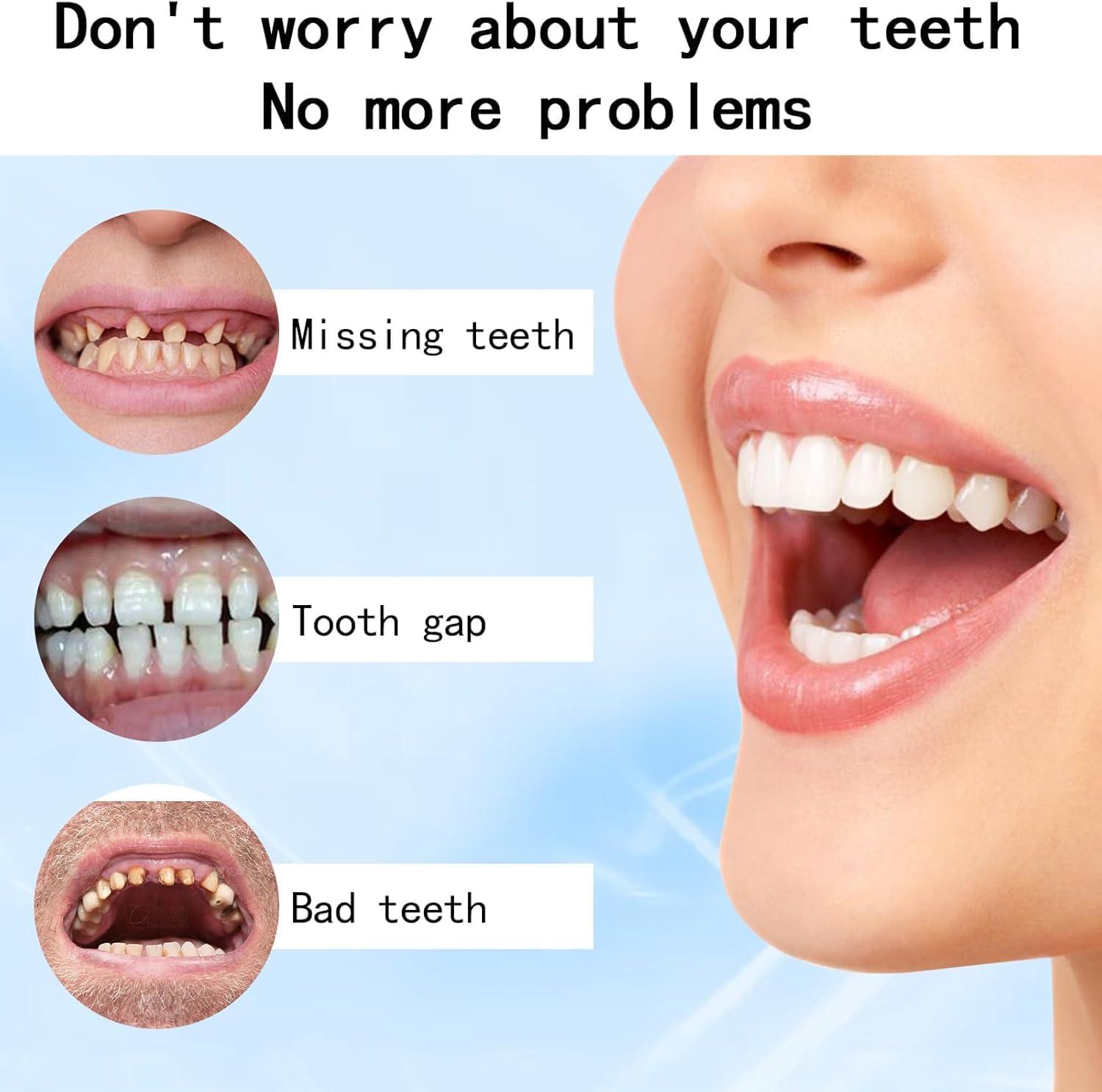 Qklovni Silicone Reline Denture Set, Silicone Denture Set, Silicone Denture Kit, Soft Silicone Denture Reline Kit, Silicone Reline for Perfect fit Dentures (1pcs)