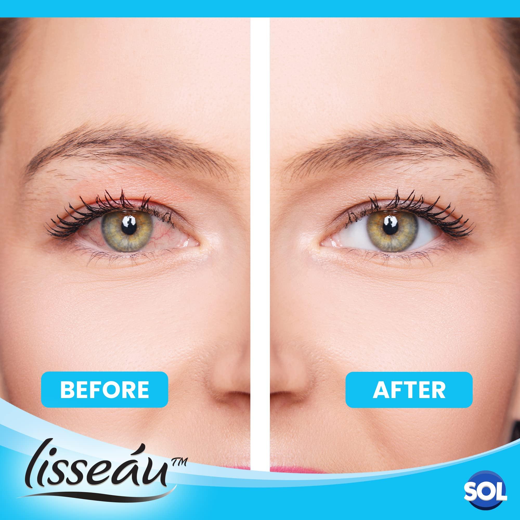 SOL SOL 6pk Eye Mist Spray - Hydrating Eye Care Solution for Dry, Tired Eyes - Soothes Irritation, Compact and Convenient for Quick Refresh Anytime, Lightweight, Travel-Friendly Spray for Everyday Comfort