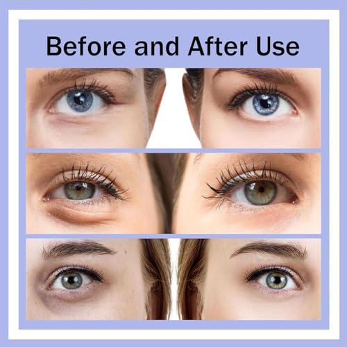 Generic Botanique Paris Under Eye Device, Revitaleyes Under Eye Red Light Therapys Glasses, Pro Eye Massager Eyes Bag Remover for Reduce Dark Circles Puffiness Wrinkles, Relax Tired Eyes