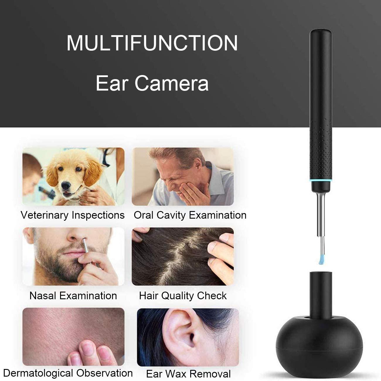 Lnobern ZhiLianZhao Intelligent Wireless Otoscope, Earwax Removal Kits with 3 Million High-precision Endoscope, Widely Compatible, Magnetic Charging Base for Daily Cleaning and Care,Red