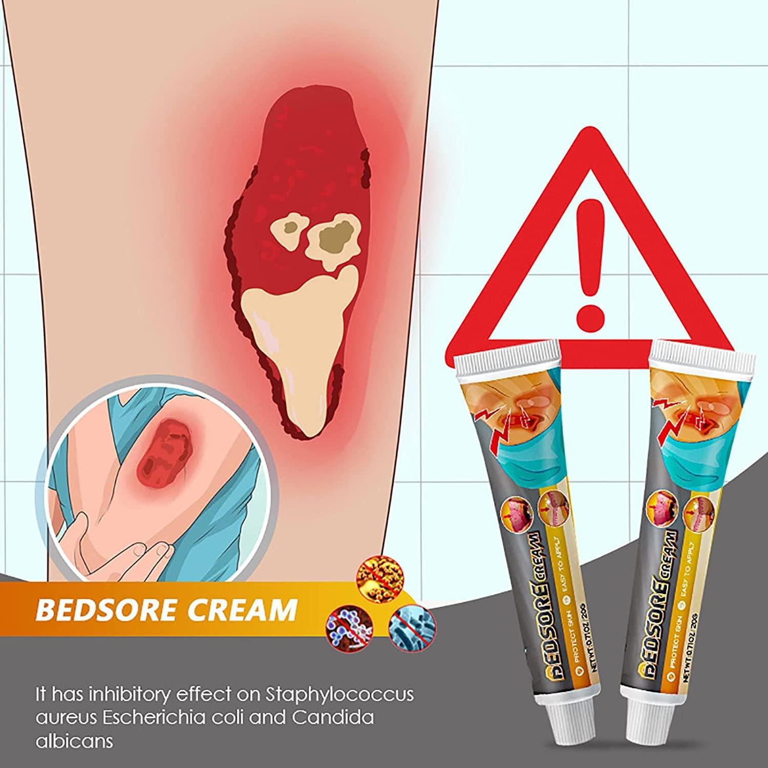 Eeiiey Bed Sore Treatment Cream,Bed Sores Healing Cream,Pressure Sore Relief Cream (1 Pcs)