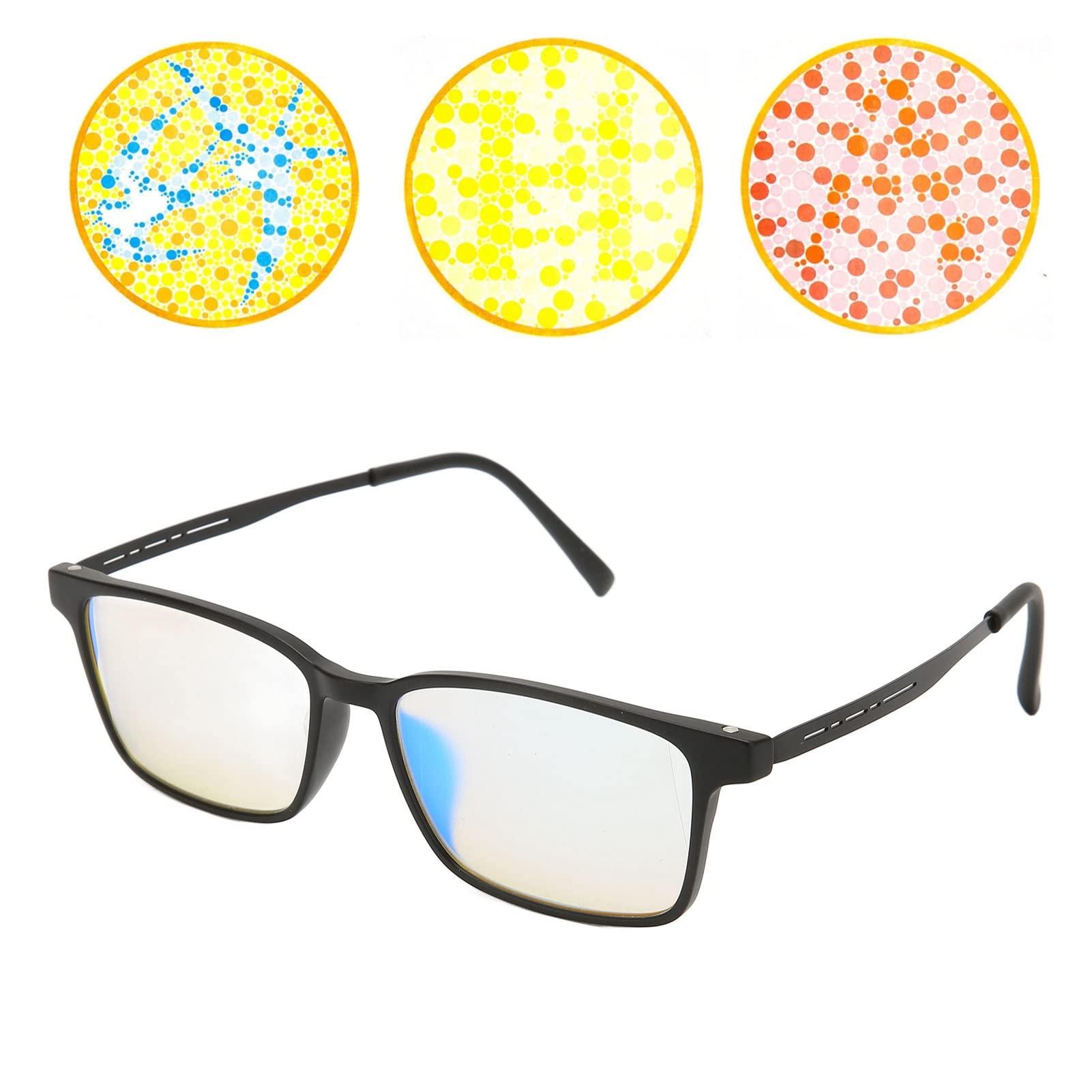 Skinnies Skinnies Medical Therapeutic Adult\'s Short Sleeve Vests, Specially Designed to Help Sufferers of Eczema & Psoriasis (White, Adult Small)