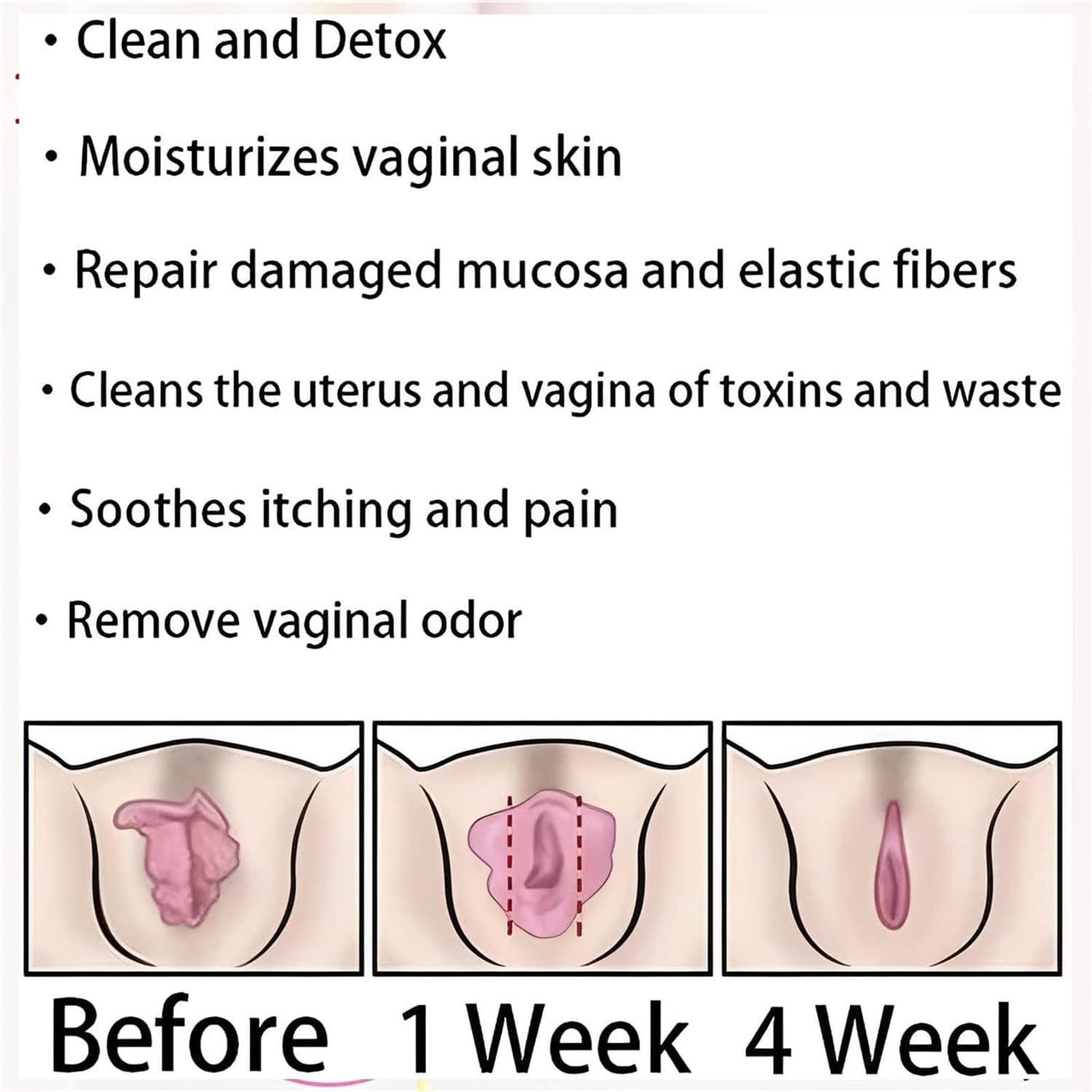 KeyoGoS Aafq Natural Repair Capsules,Aafq Capsules for Women, Aafq Detox Repair, Itch Detox Slimming Products, Natural Detox Viginal Gel, Revert to Tight and Tender State (4 Bags)