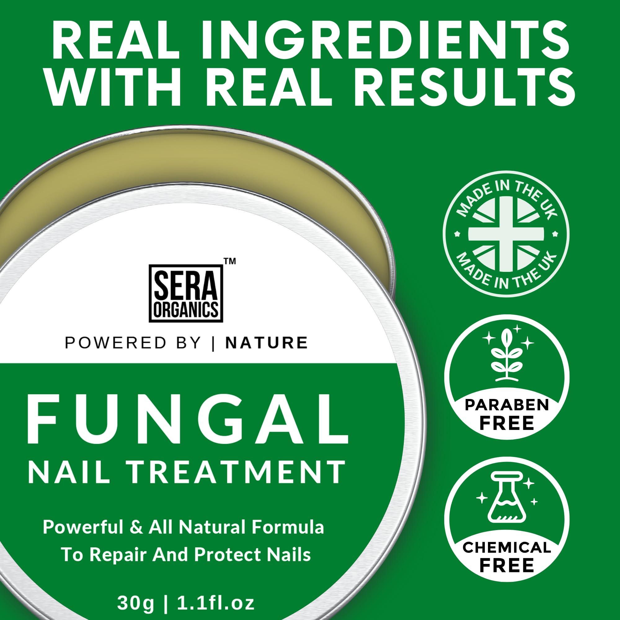 Sera Organics Fungal Nail Treatment Cream - Antifungal Ingredients Natural Strong Anti-Fungal Nail Treatment For Toenail Fungus, Foot Cream With Nourishing Oils For Nail Growth & Nail Repair (30ml) By Sera Organics