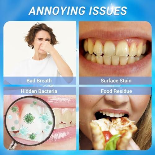 Sovtay Xoermioy Niacinamide Whitening Toothpaste, Bodyaccel Niacinamide Whitening Toothpaste, Bodyaccel Niacinamide Toothpaste, Dazzle White Toothpaste, Remove Stain and Whitening (3PCS)