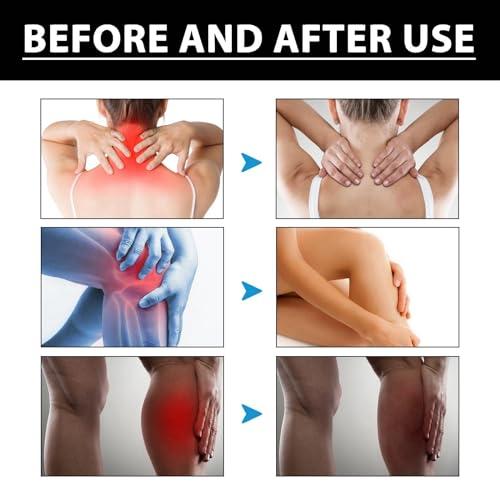 HIVETZ 2PCS New Zealand Bee Venom Joint Relief Gel,Muscle Pain Relief,Bee Venom Professional Treatment Gel,Joint Pain Relief,Bee Venom Joint Soothing Gel,Pain Relief Cream,Muscle Rub Pain Relief,Bee Cream