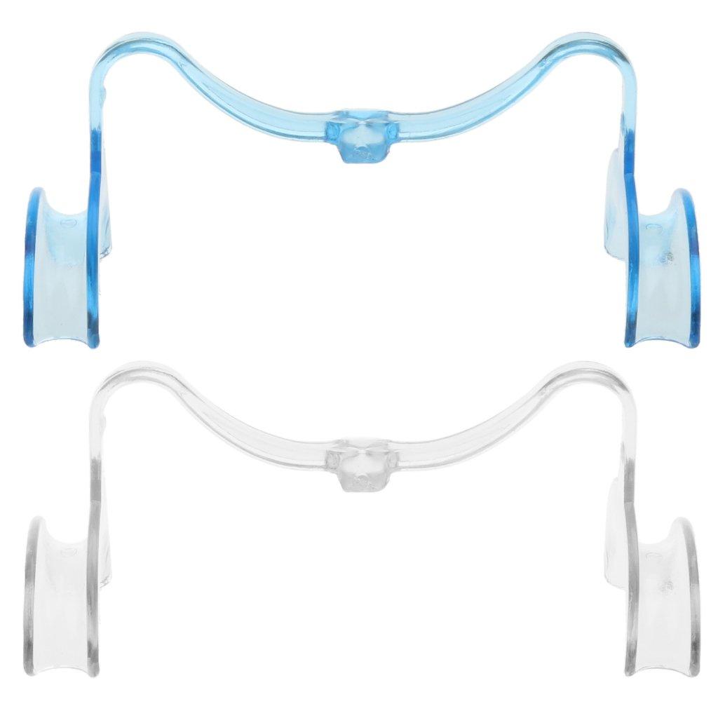 Tiuimk Tiuimk Transparent U-Shaped Dental Cheek Retractor - Medium Size for Clear Oral View