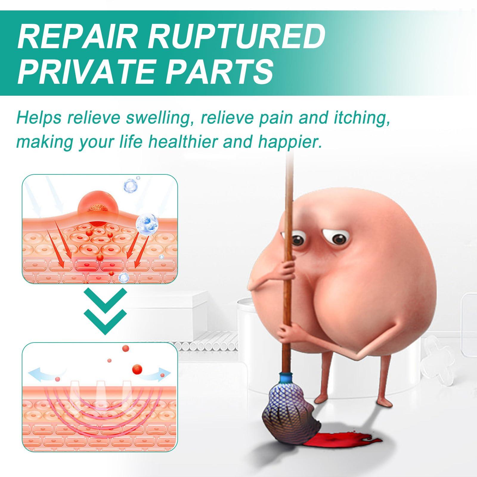 EasPowest Herbal Hemorrhoids Cream MediLisk, MediLisk Herbal Hemorrhoids Cream for Women and Men (3 Pcs*20g)