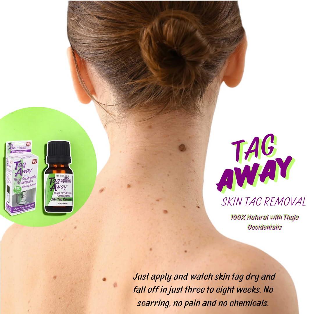 Tag Away Tag Away Skin Removal, 10mL (0.34 fl. oz.)