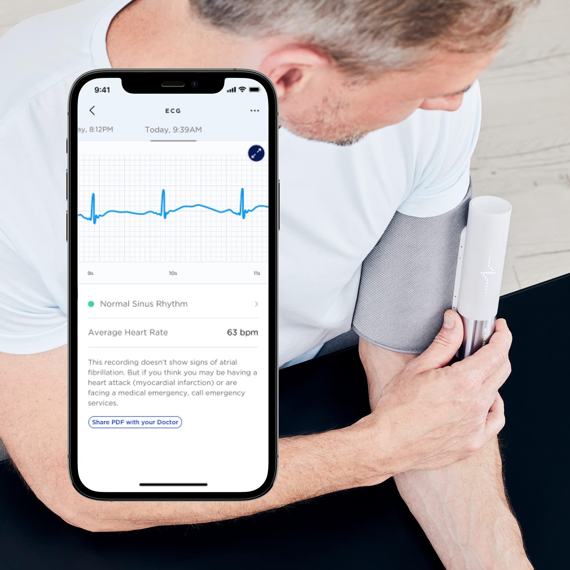 Withings Withings BPM Core - Electric Arm Blood Pressure Monitor with ECG and Digital Stethoscope, Wi-Fi Synchronization