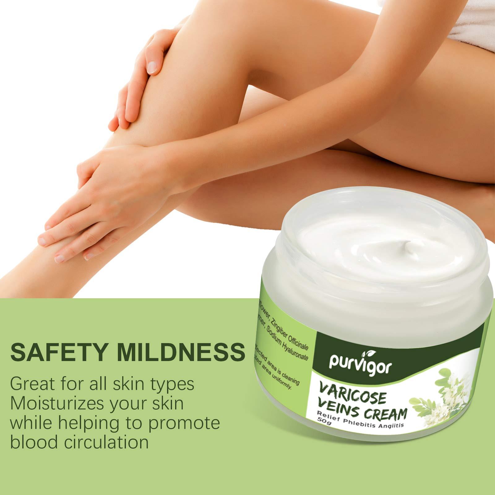 purvigor Varicose Veins Cream, Varicose Vein & Soothing Leg Cream, Natural Varicose & Spider Veins Treatment, Strengthen Capillary Health, Improve Blood Circulation, Tired and Heavy Legs Fast Relief