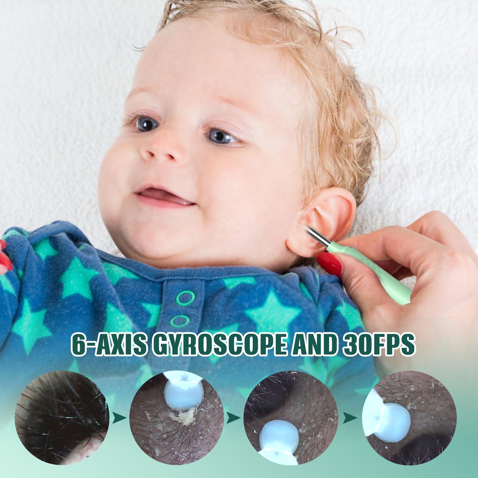 LMECHN LMECHN Ear Wax Removal, Ear Camera Otoscope with LED Light, Ear Wax Removal Kit with 1080P, 3.5 mm Waterproof Ear Endoscope, Ear Cleaning Kit for iPhone, iPad, Android Phones-Green