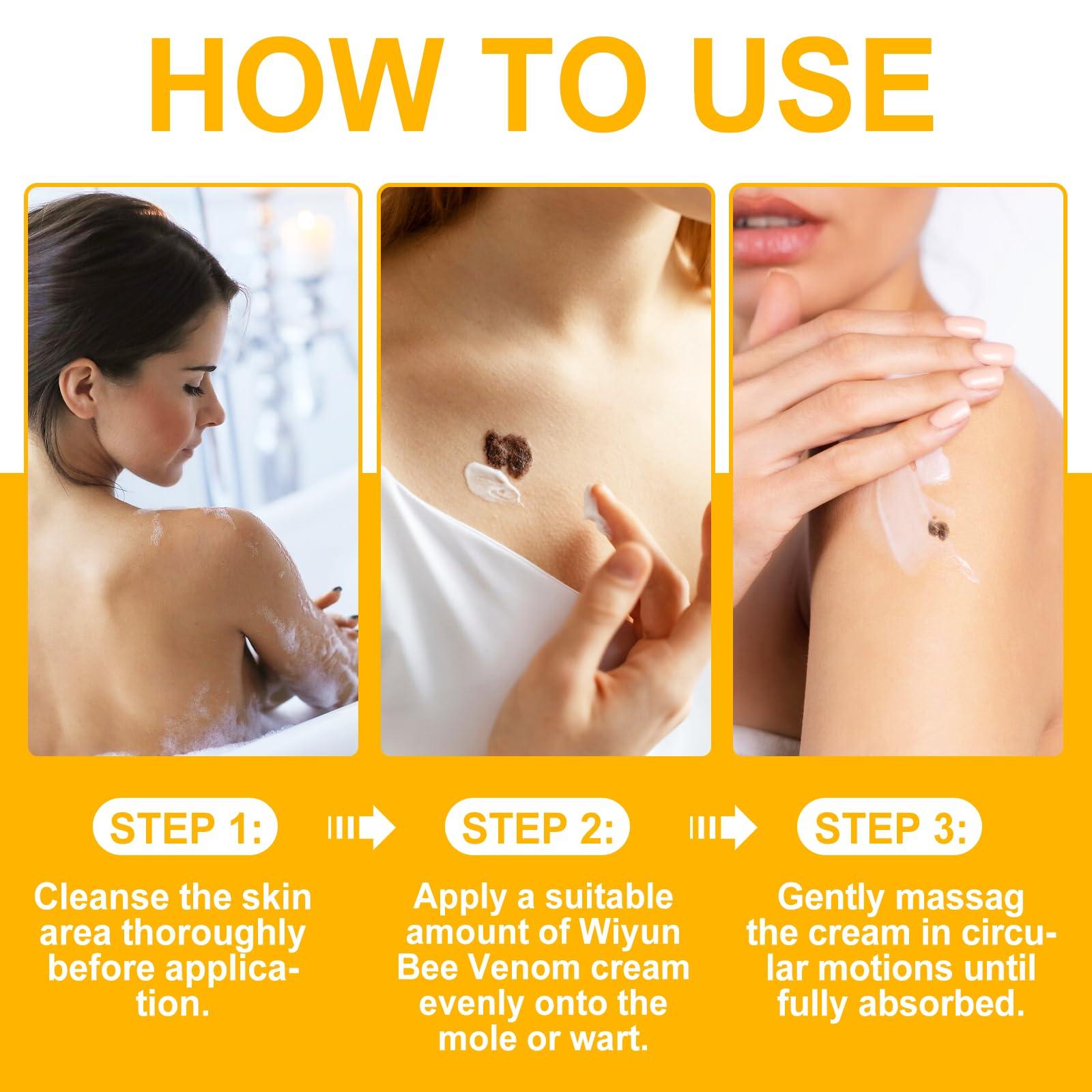 XAYGHE Bee Venom Cream, Bee Venom Wart and Tag Removal Treatment Cream, Hydrating Moisturiser, Removes Spots, Soothes Skin, for All Skins