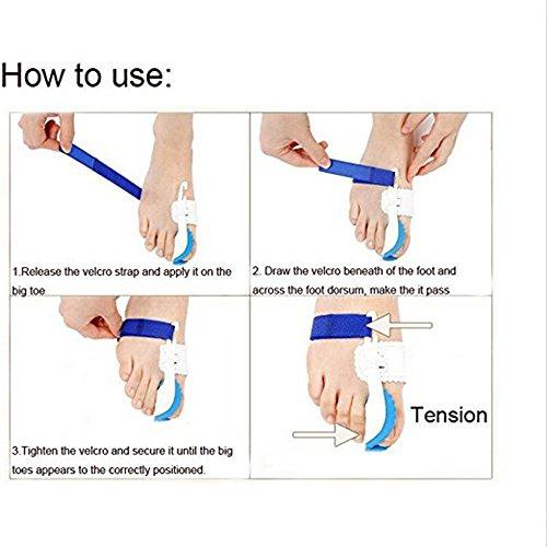 Pedimend Hallux Valgus A Pair of Big Toe Bunion Straighteners Night Splint Pad Correctors PEDIMEND - Foot Central Arch State Stable - Toe Straightener for Hallux Valgus, Hammer Toe Pain Relief with 2 PCS