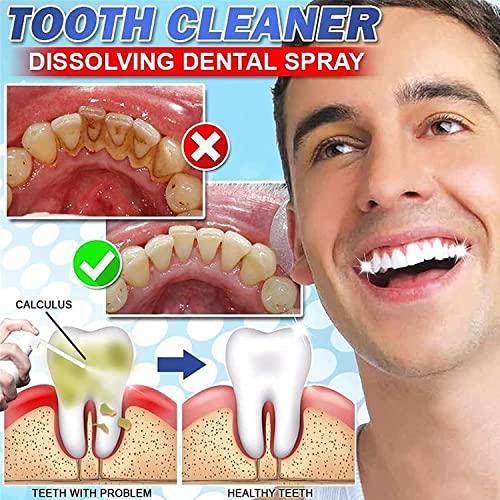 Anshka 30ml Calculusfree Dissolving Dental Spray,Dental Calculus Remover Teeth Cleaner,Mouth Refreshing Spray,Plaque Remover for Teeth Mouthwash,Intensive Stain Removal Toothpaste (2pcs)