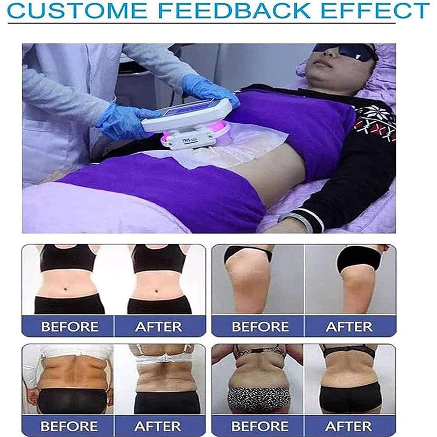 LZDOYY LZDOYY Cryolipolysis Machine Fat Freezing Machine Fat Freezing Treatment Freezing Lipolysis Machine Fat Freezing Slimming Beauty Machine To Lose Weight Burn Fat Slimming Body Sculpting,220V