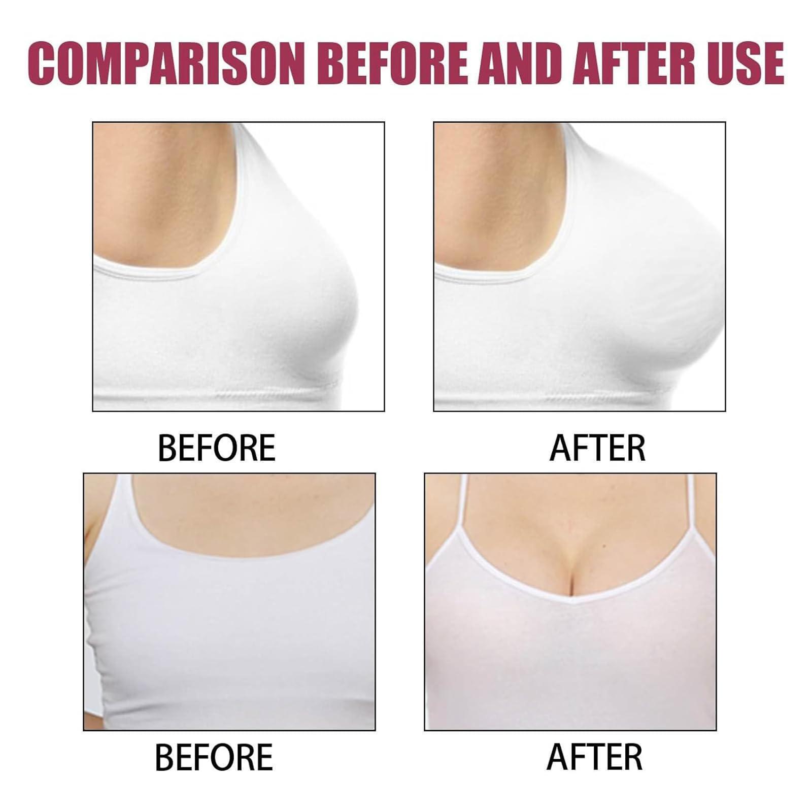 VAWSVOCS Breast Enhancement Patch, Keratopeptide Protein Breast Enlargement Firming Pad, Breast Enhancement Patch, Promotes Firming Lifting, Breast Enhancement Patch, All Skin Types