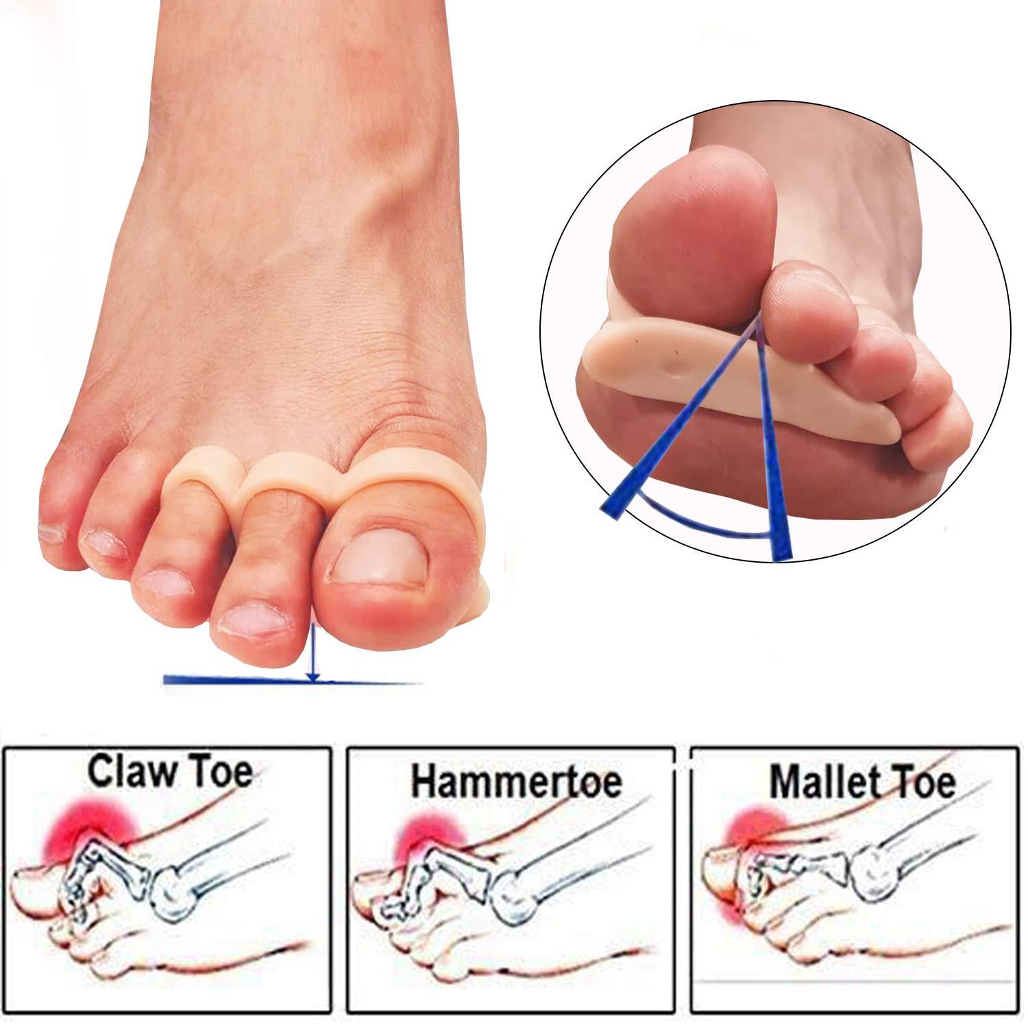 Mcvcoyh Mcvcoyh Gel Hammer Toe Crests Pads x 10 Pcs Silicone Toe Cushion Support for Hammer Toe, Overlapping Toes, Curled Toe-3 Loops
