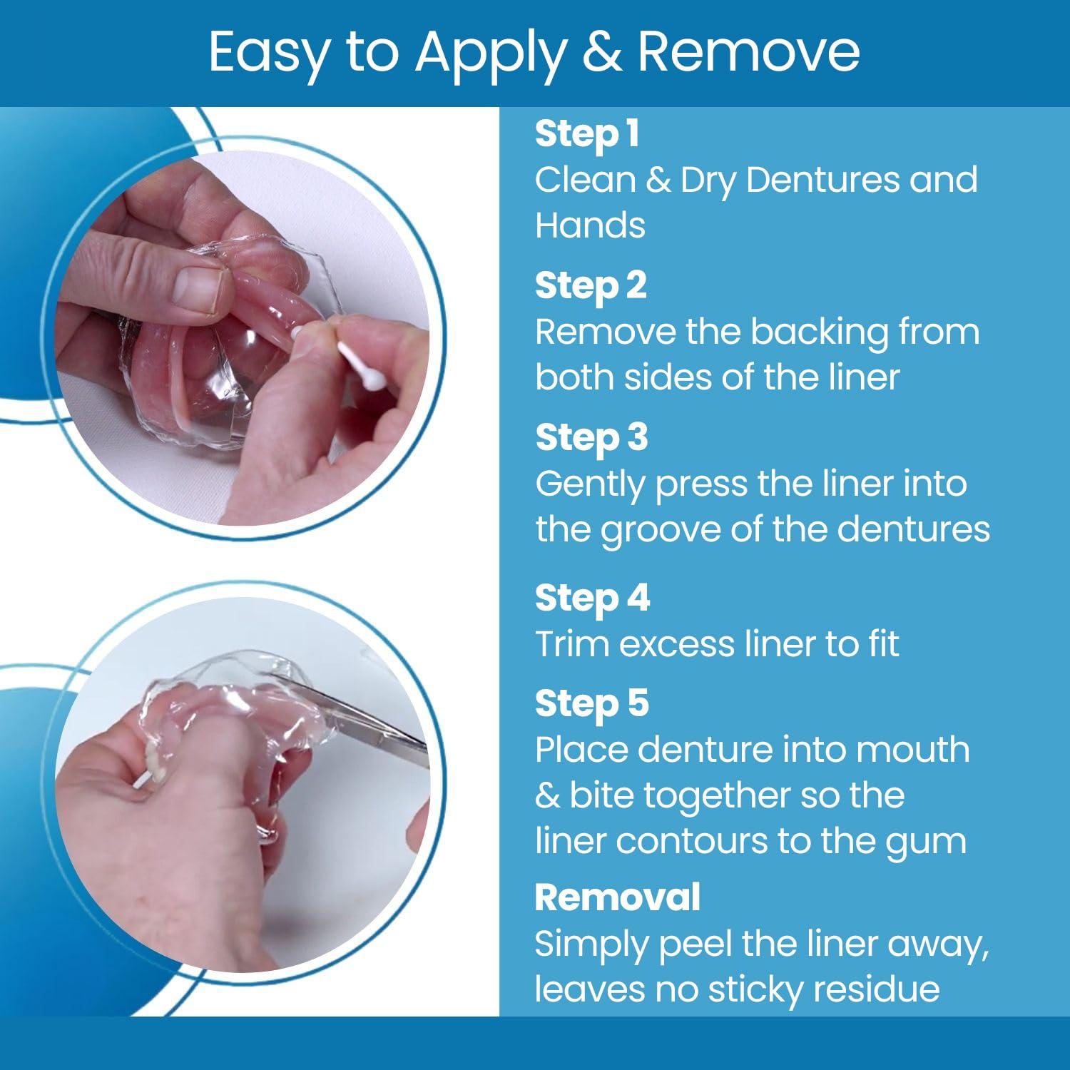 Denturecare Clear Comfort Denture Liner - Secure Fit - No Hassles Application - Long-Lasting Denture Adhesives - Easy to Maintain Cushion Comfort Denture Liner