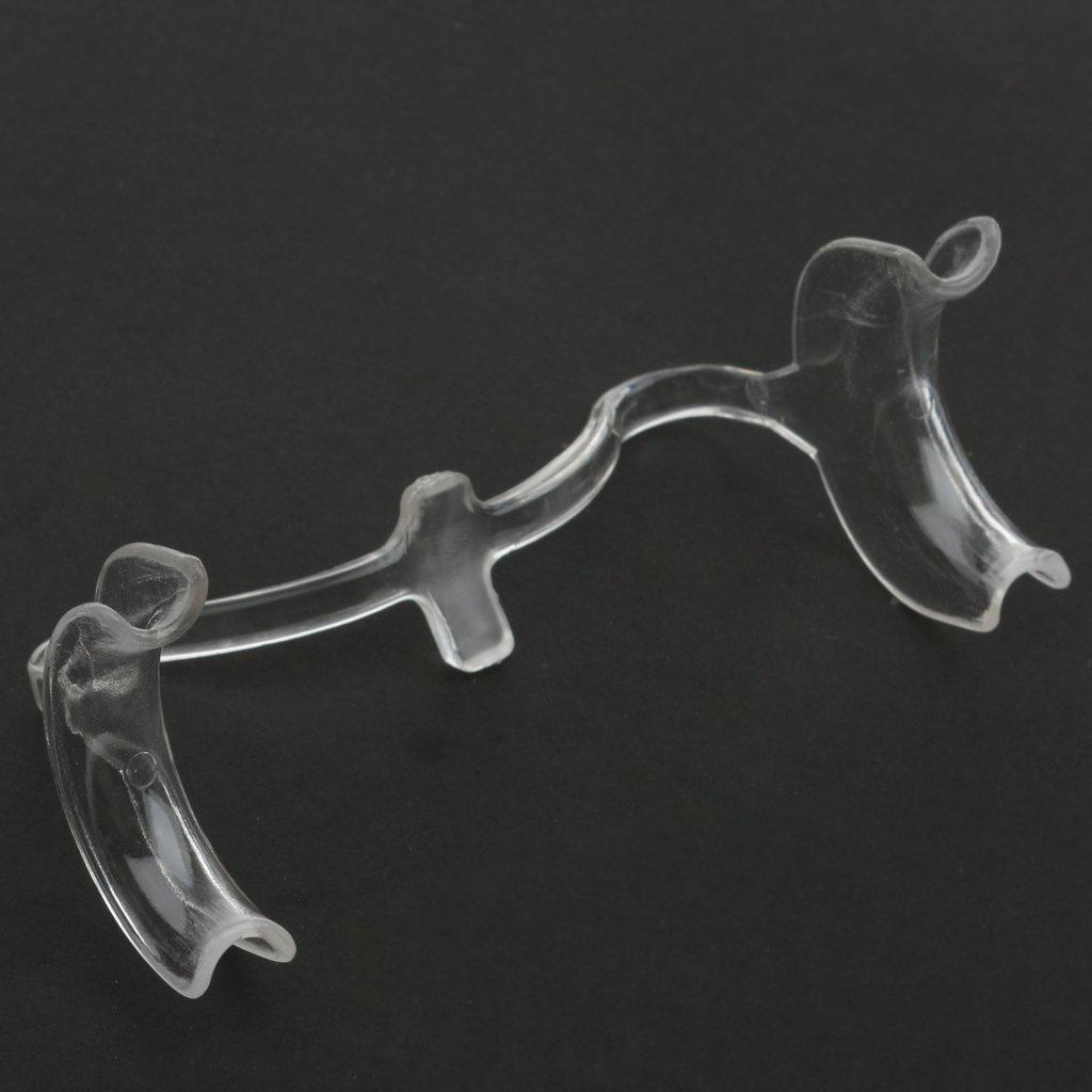 Tiuimk Tiuimk Transparent U-Shaped Dental Cheek Retractor - Medium Size for Clear Oral View