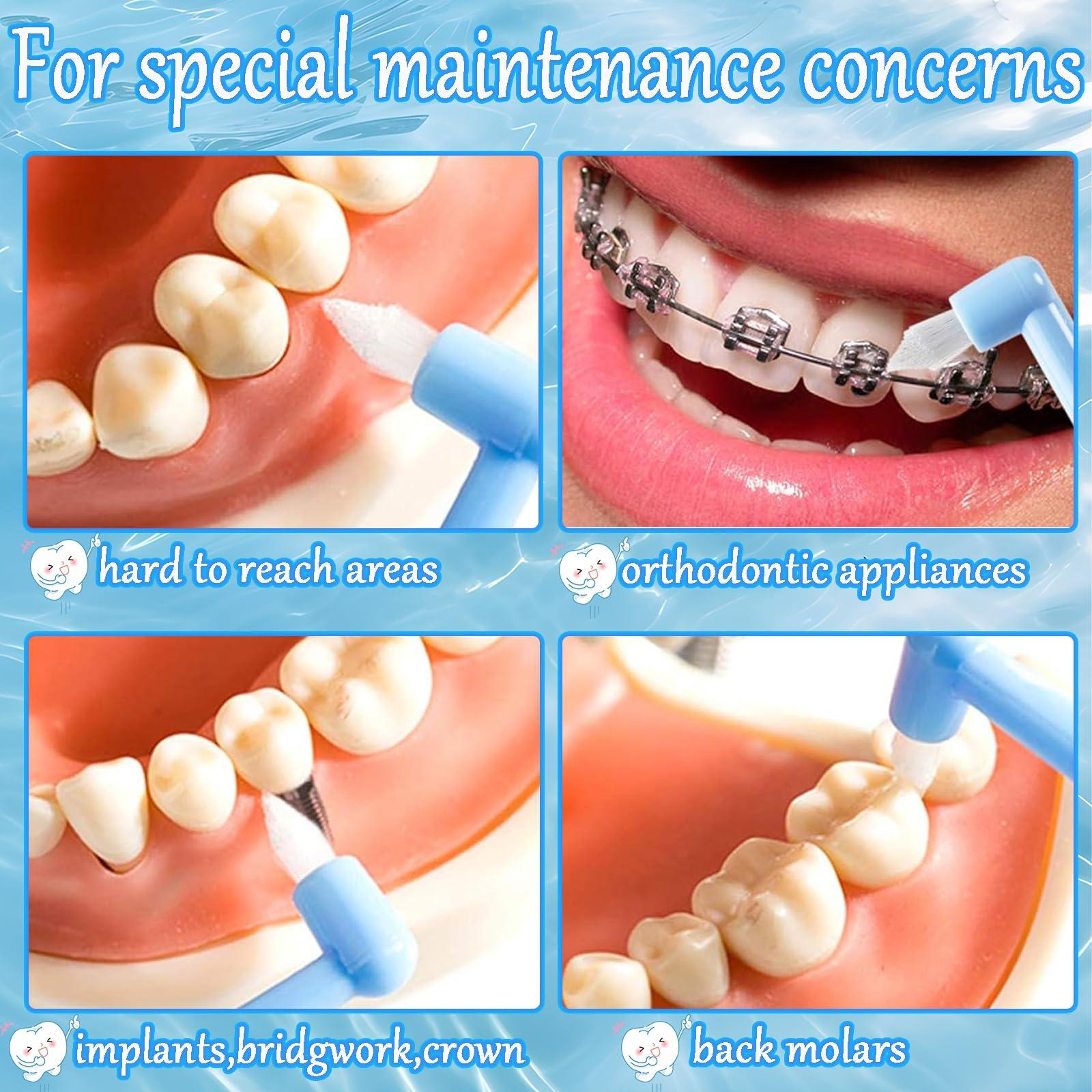 PSFYRN Single Tufted Toothbrush,Dental Brushes,5 Pcs End-tuft Tapered Toothbrush Orthodontic Toothbrushes,Braces Toothbrush and Interspace Toothbrush,for Detail Cleaning