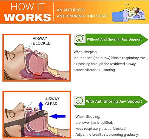 OBODN OBODN Anti My Snoring Snore Solution - Anti Snore Chin Strap For Sleep Mask, Anti Snoring Snore Chin Strap Large, Snore Chin Strap, Snoring Snore Device That Work