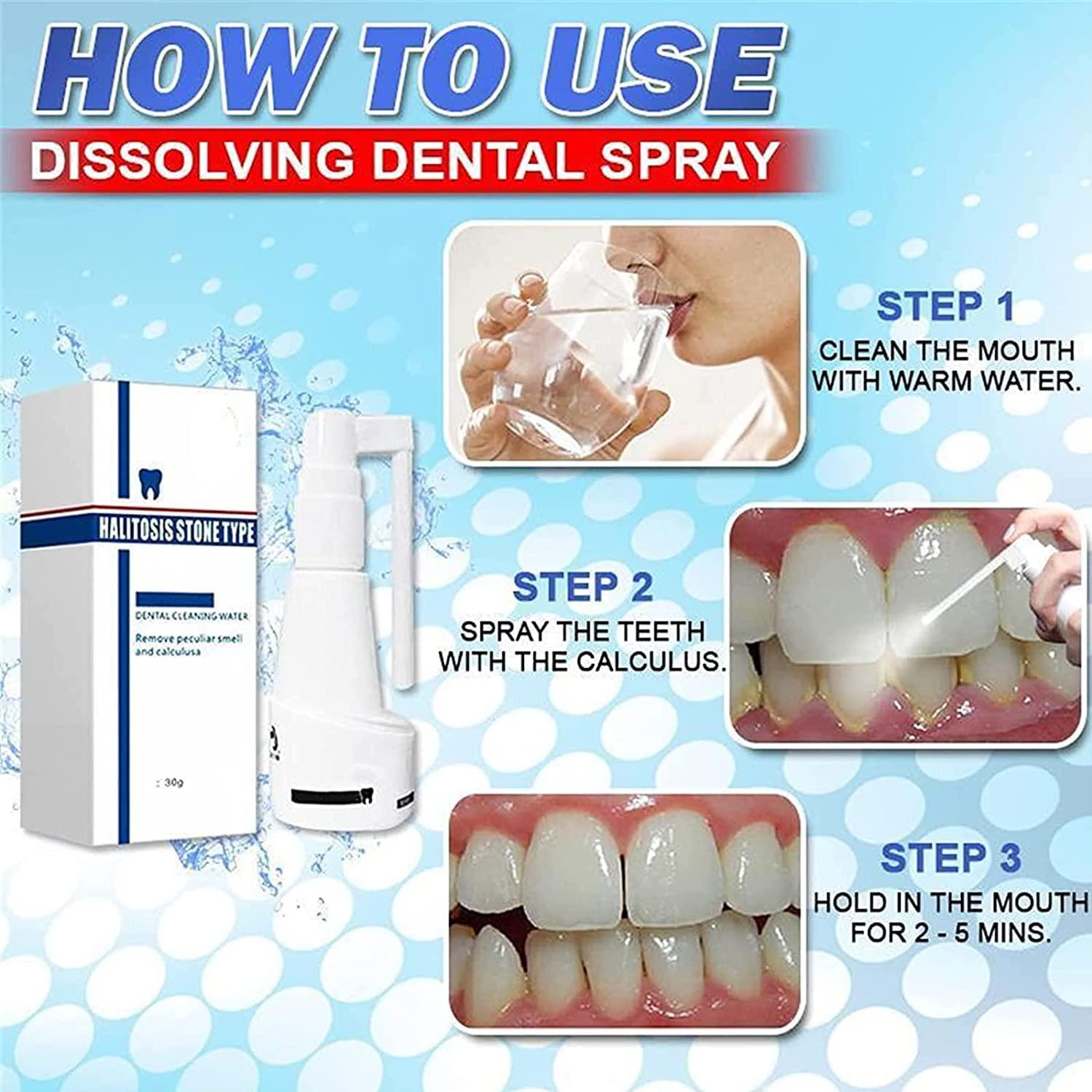 Anshka 30ml Calculusfree Dissolving Dental Spray,Dental Calculus Remover Teeth Cleaner,Mouth Refreshing Spray,Plaque Remover for Teeth Mouthwash,Intensive Stain Removal Toothpaste (2pcs)