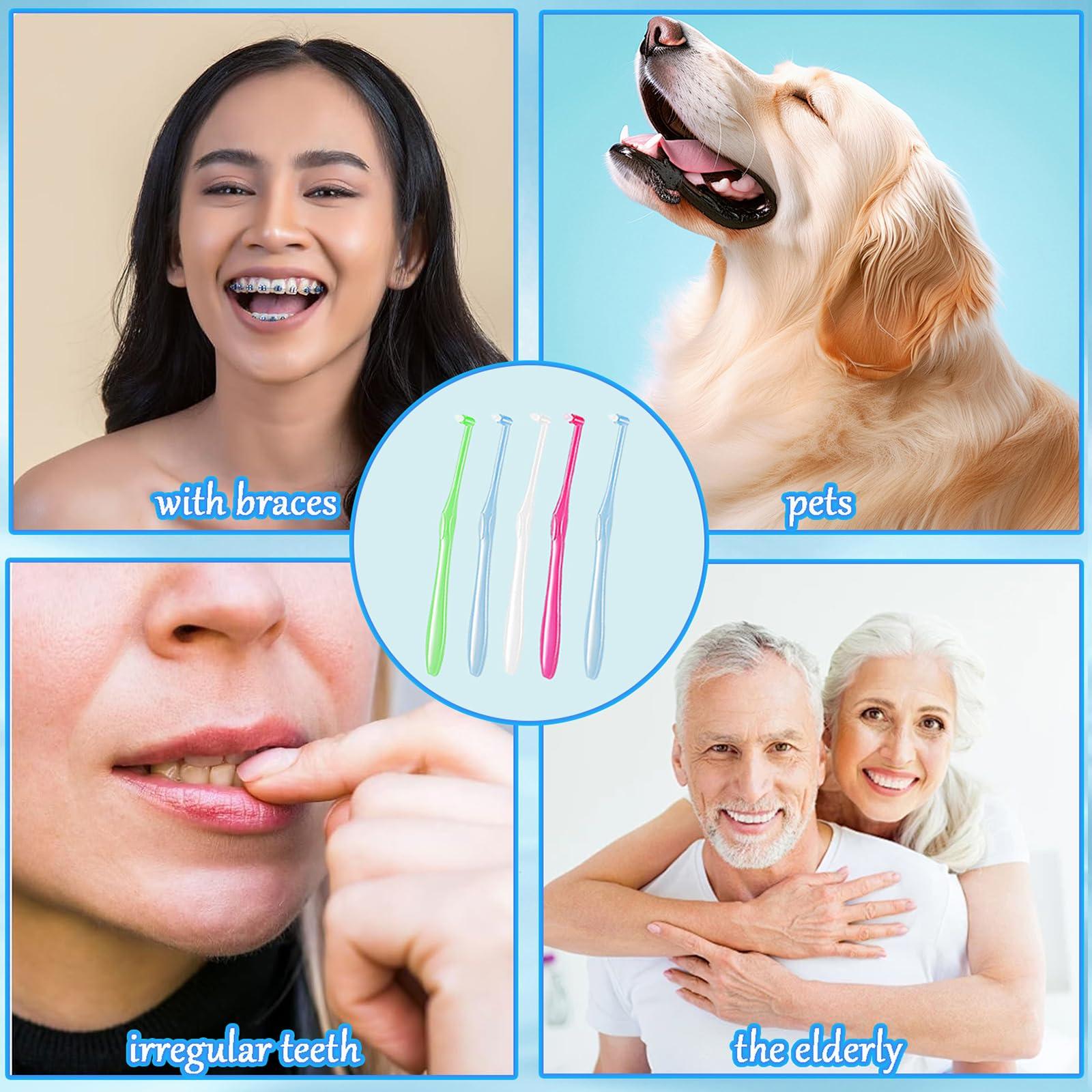 PSFYRN Single Tufted Toothbrush,Dental Brushes,5 Pcs End-tuft Tapered Toothbrush Orthodontic Toothbrushes,Braces Toothbrush and Interspace Toothbrush,for Detail Cleaning