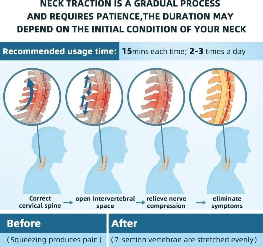 kumosaga kumosaga Kyrolabs Cerviflex Neck Stretcher, Cervical Neck Traction Electric Device, Kyrolabs Neck Brace for Neck Decompression and Neck Tension Relief, with 3 Power Traction and 8 Airbag Support