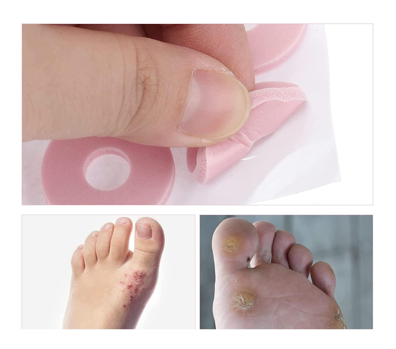 LR Supplies Corn Plasters Foam Cushion Ring Pads Callus Foot Health Toe Pain Adhesive Care