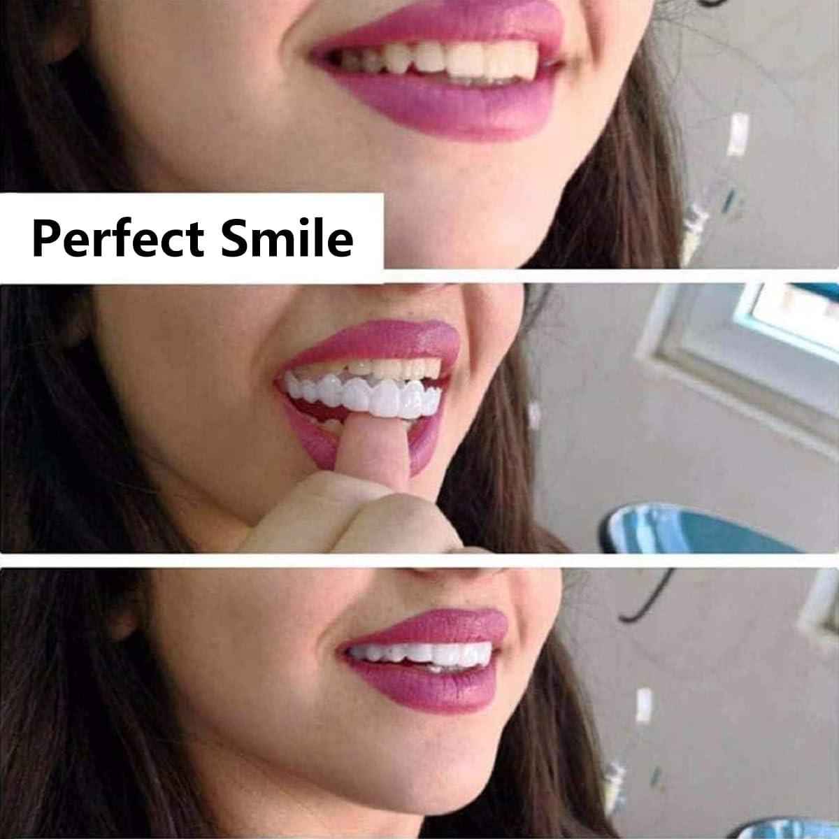 Wttfc 2 Pairs False Teeth Clip in Teeth Instant Perfect Smile Teeth Veneers Comfort Fit Flex Cosmetic Teeth Braces Cover Bad Teeth Top And Bottom for Men And Women Adult