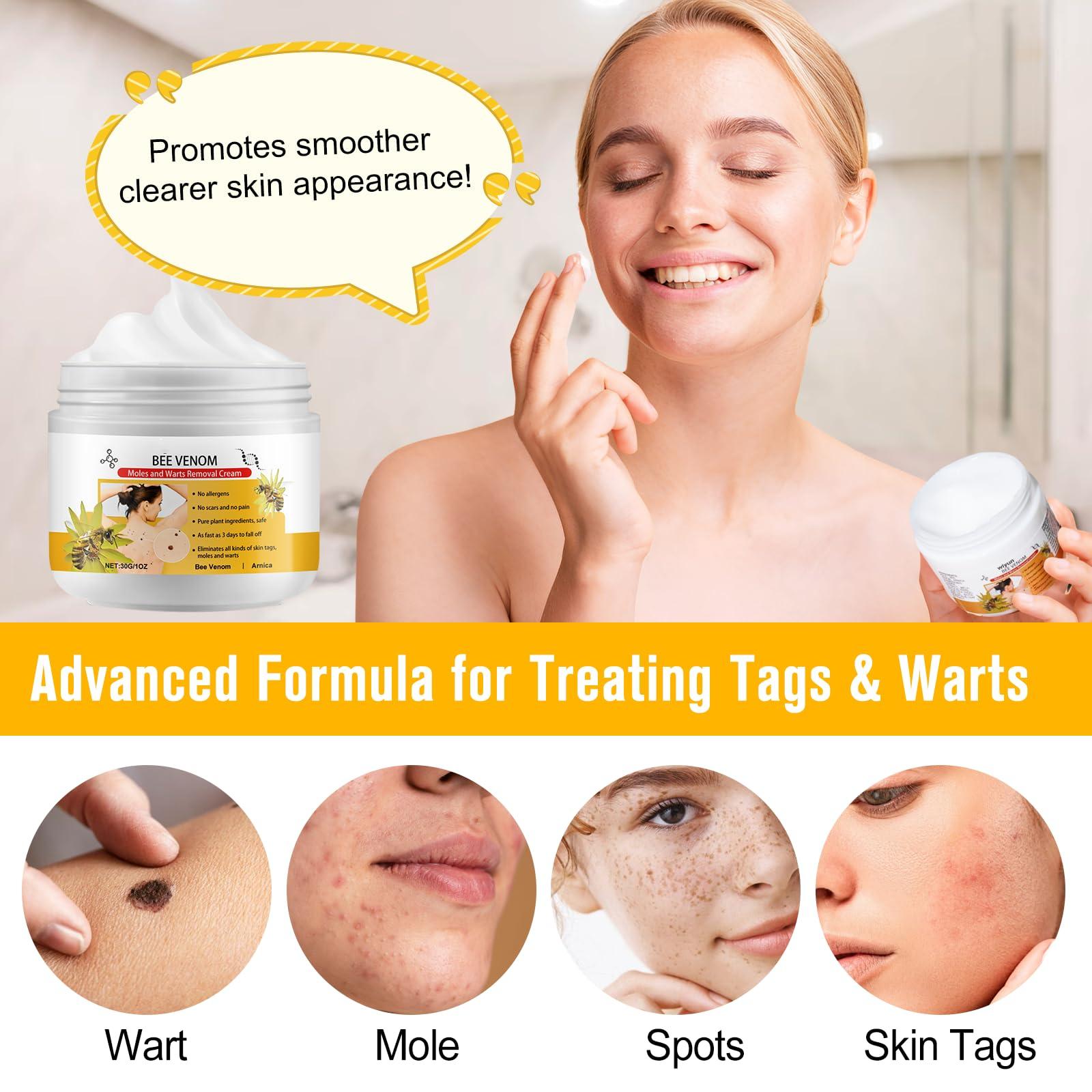 XAYGHE Bee Venom Cream, Bee Venom Wart and Tag Removal Treatment Cream, Hydrating Moisturiser, Removes Spots, Soothes Skin, for All Skins