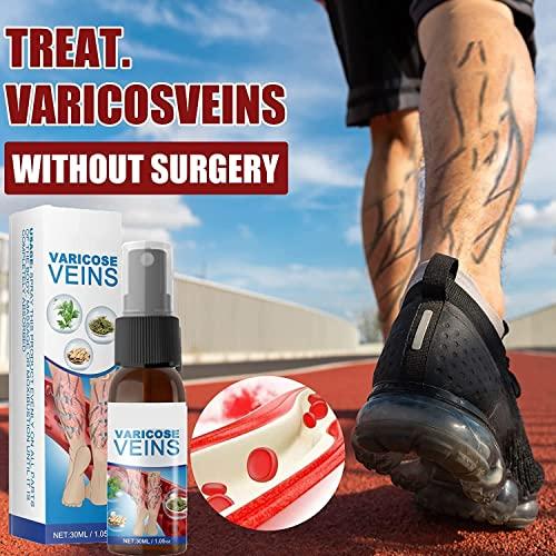 Anshka Varicose Veins Spray,Varicose Veins Care Spray,Veinhealing Varicose Veins Treatment Spray,for Legs Improve Blood Circulation,Relief Phlebitis Angiitis Varices Inflammation (1pcs)