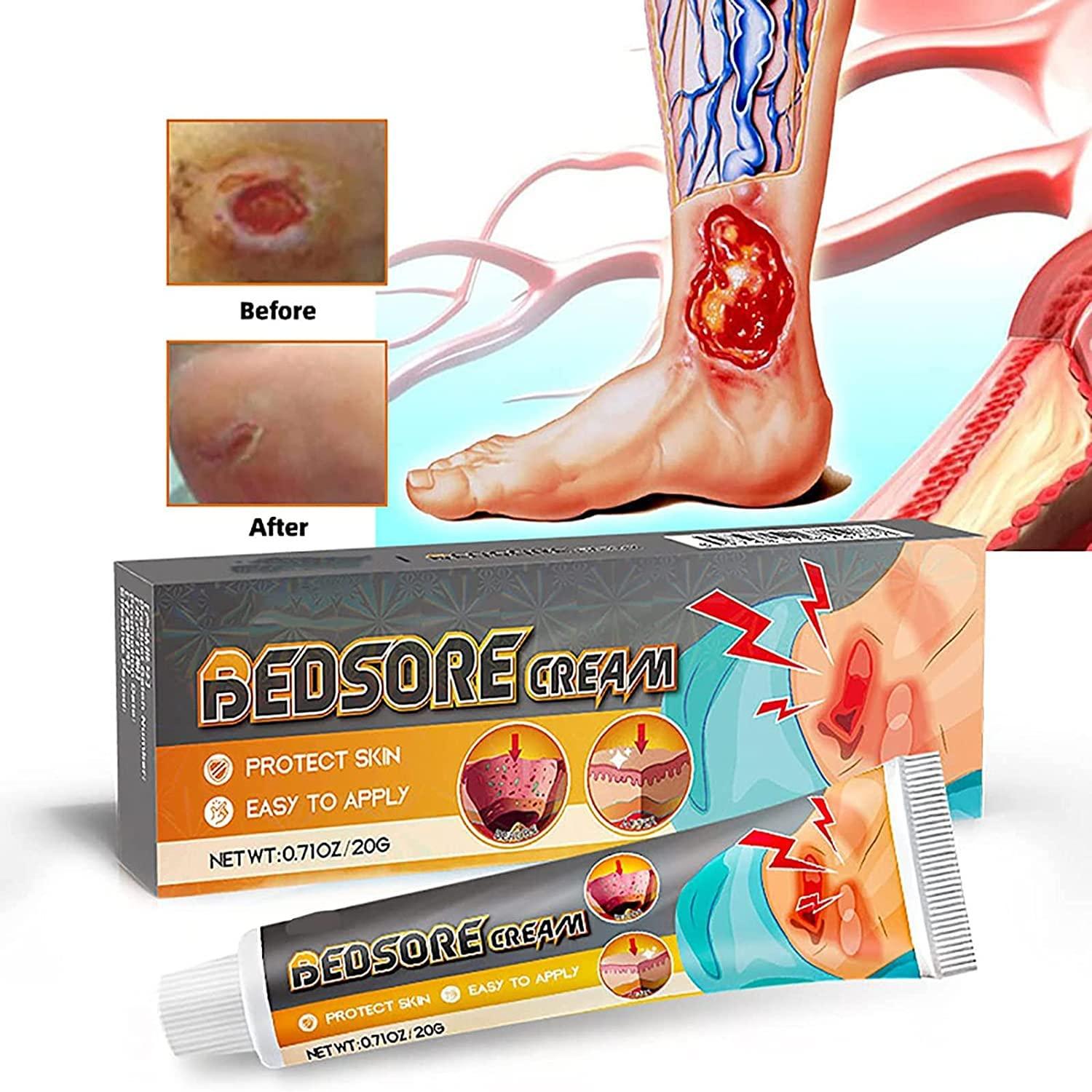 Eeiiey Bed Sore Treatment Cream,Bed Sores Healing Cream,Pressure Sore Relief Cream (1 Pcs)