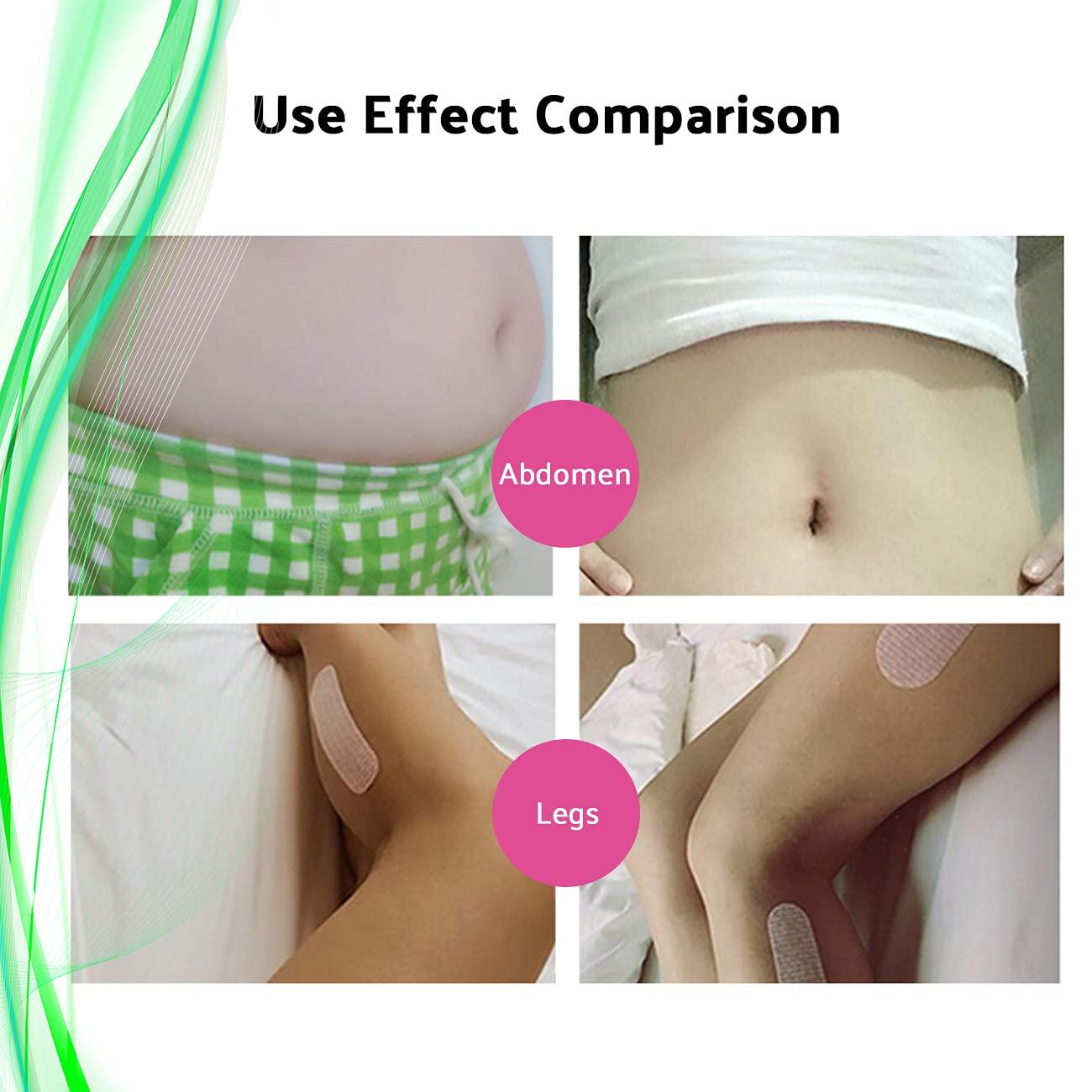 Lnobern ZhiLianZhao Leg Paste Thin Calf, Professional Women Skin Care, with Easy To Carry, Skin Tightening, Wrinkle Reducing