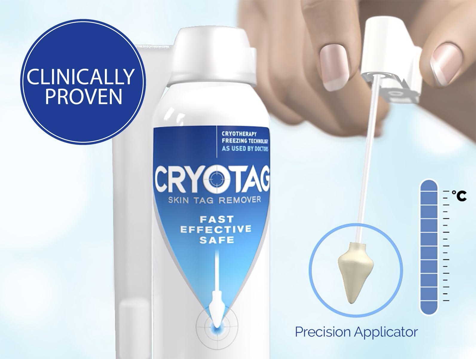 Cryotag Cryotag Skin Tag Remover - Fast Effective Safe Skin Tag Removal- Removes Skin Tags in as little as 1 treatment, Clinically Proven, Up to 12 treatments
