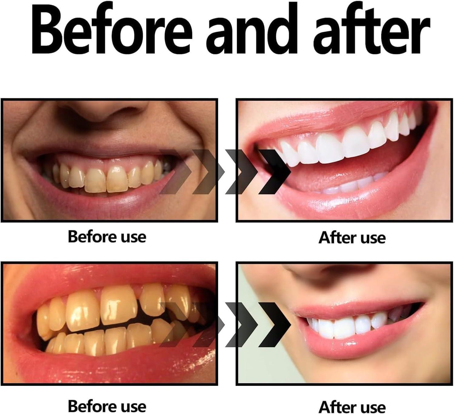 Endxedio Cleopatras Natural Teeth Whitening Powder, Cleopatra\'s Natural - Natural Teeth Whitening Powder, Cleopatra\'s Tooth Powder Gently Cleans Teeth (1)