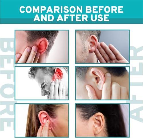 Giurui EchoPure Organic Ear Support Elixir, Tinniease Spray for Tinnitus, Tinnitus Relief for Ringing, Relieve Ear Discomfort (2 Pcs)