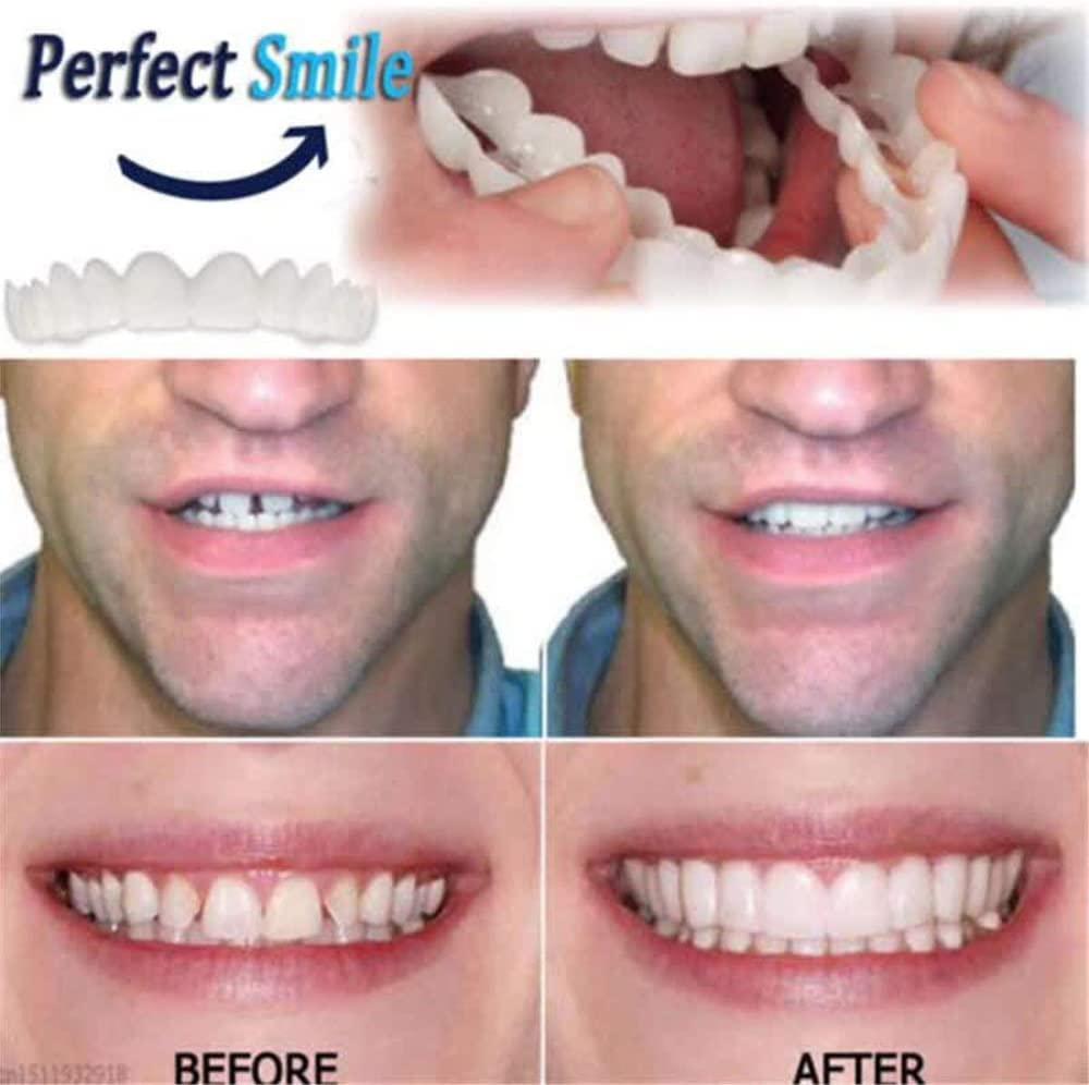 Flipped Warmth Flipped Warmth 2 Pair Instant Veneers Teeth Dentures Fake Teeth, Cosmetic Tooth Covering Snap Smile Teeth, Clip on Veneers Top and Bottom False Teeth for Men and Women