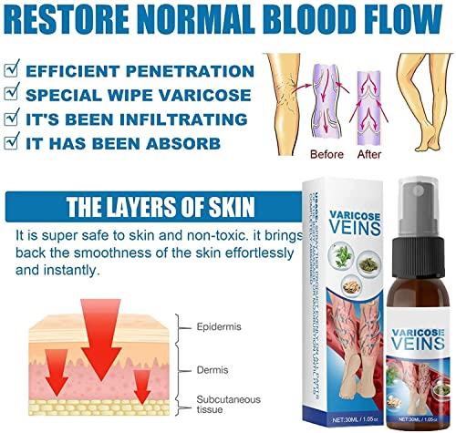 Anshka Varicose Veins Spray,Varicose Veins Care Spray,Veinhealing Varicose Veins Treatment Spray,for Legs Improve Blood Circulation,Relief Phlebitis Angiitis Varices Inflammation (1pcs)