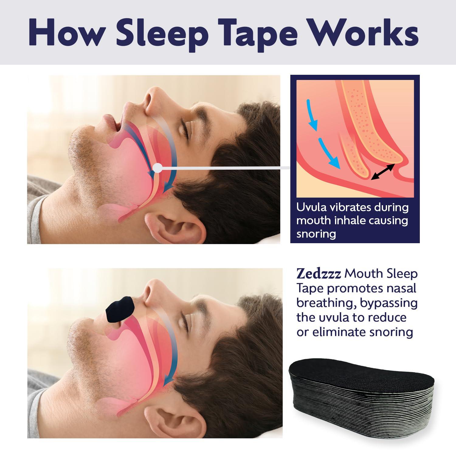 Zedzzz Sleep Zedzzz Mouth Tape for Sleeping (35 Strips) | Anti Snoring Aid for Men & Women | 5+ Weeks of Sleep Tape Strips | Sleep Aid | Anti Snoring Devices Mouth Tape | Snore Stopper | Reusable Mouth Tape