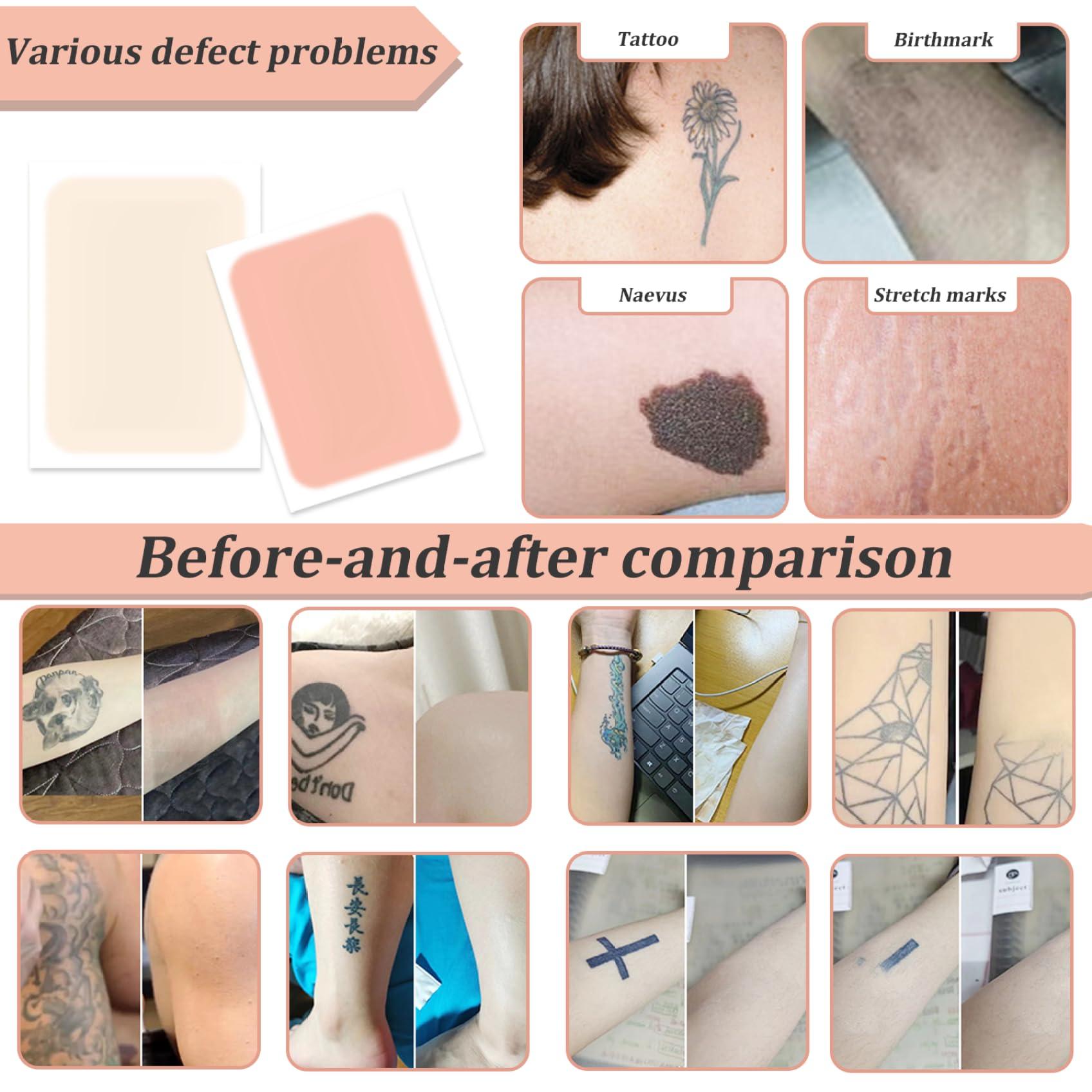Weduspaty Tattoo Cover Up Patch 10Pcs Waterproof Tattoo Cover Up Tape 2 Colors Breathable Tattoo Concealer Sticker Ultra-Thin Skin Tattoo Cover Invisible for Tattoo ScarBirthmarks Style 1